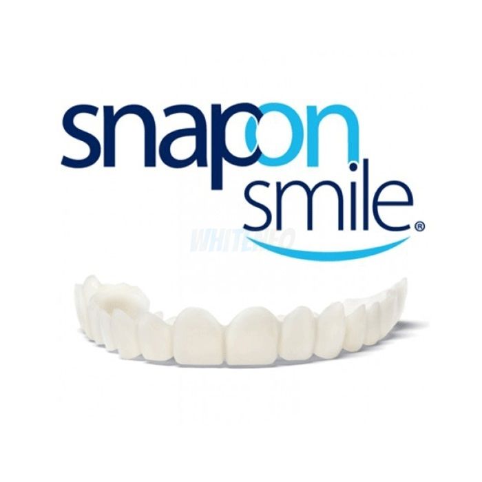 ⤷ Snap-On Smile - dýhy